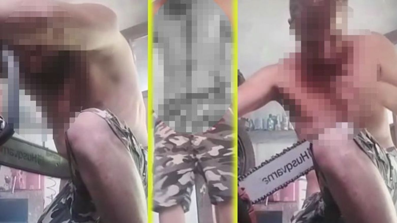 Te jó ég! Élőben nézték a TikTokon, hogy egy férfi megsebesítette magát láncfűrésszel