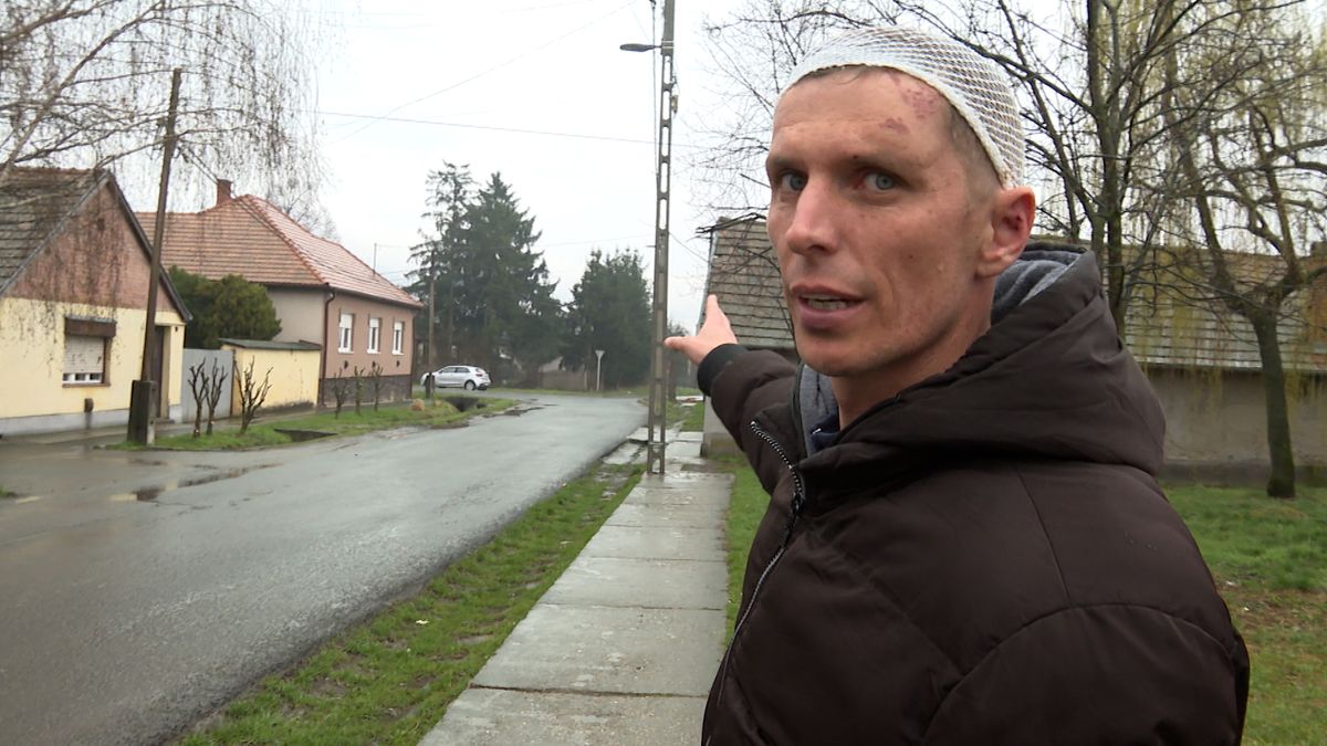 A verekedés egy csendes pásztói utcában történt még szombaton este. Zsolt megmutatta, hol támadta meg a három drogos